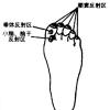 老年痴呆线脚底图解2