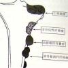 骨肿瘤图片2